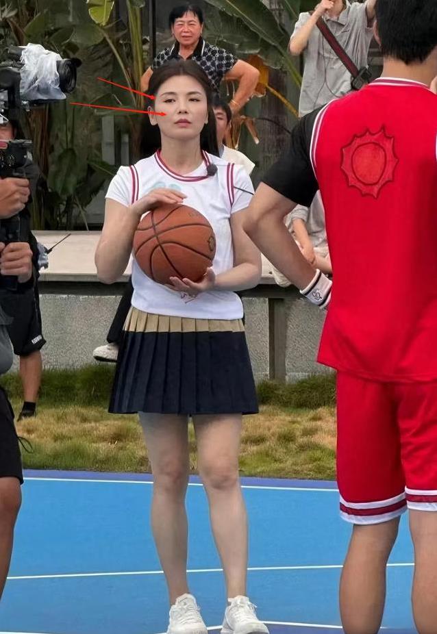 明星也是人, 说到她的牙